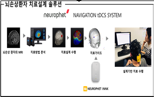 뇌손상 환자 치료전략 인공지능(AI) 기술 개발 이미지